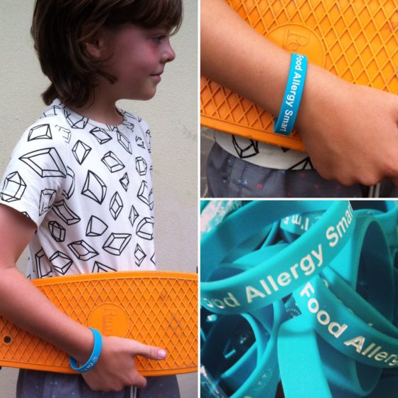 Food Allergy SMART allergy bands